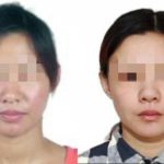 逃亡十年终落网！整容换脸的诈骗夫妻逛动物园时被一眼识破-彩票论坛-彩票技巧策略